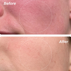 Ruddi - Redness Control Daily Moisturizer